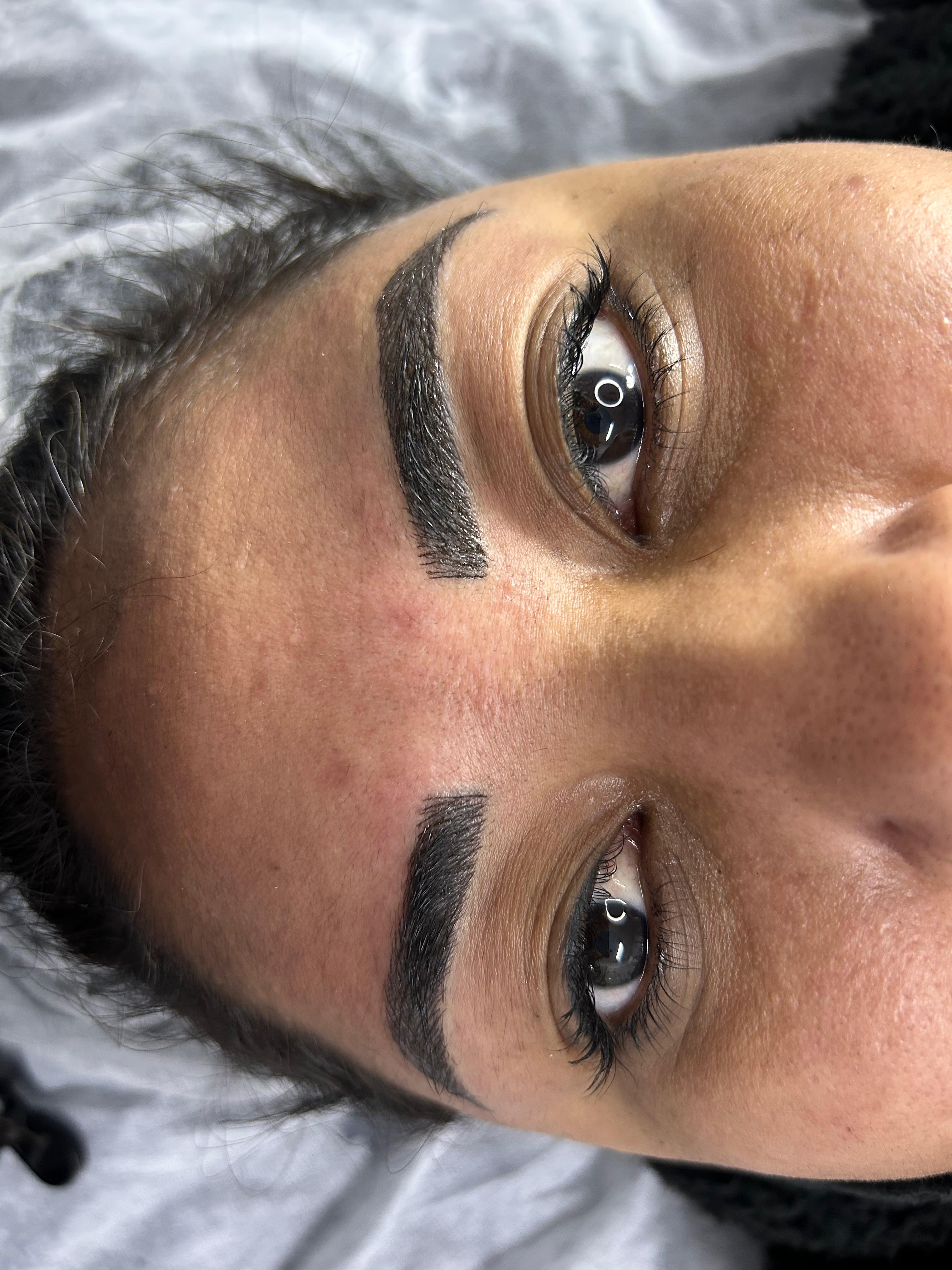 Depois da Micropigmentação